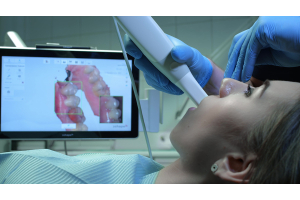 Dentists Scanning Patient with Intraoral Camera