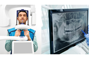 Panoramic X-ray Guide