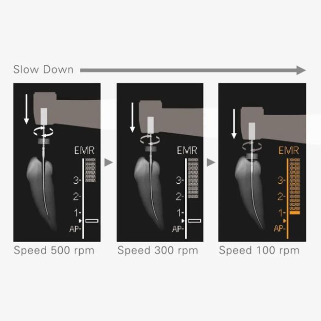 J Morita TRI Auto ZX2+ Cordless Endo Motor Dental Handpiece - D