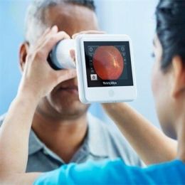 Handheld RetinaVue 100 Imager with Charging Dock - D