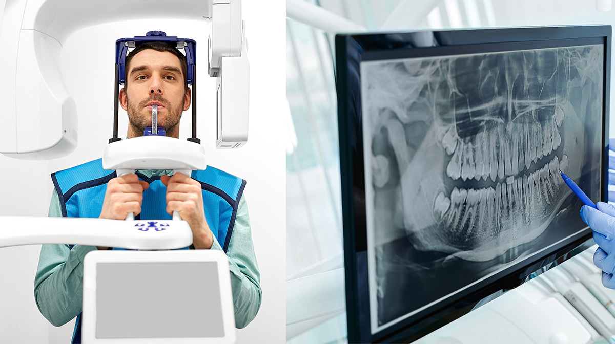 Panoramic X-ray Guide